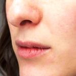 Rahasia Bibir Sehat Sepanjang Musim Dingin Panduan Lengkap Cara Mengatasi Bibir Pecah Pecah Di Cuaca Dingin